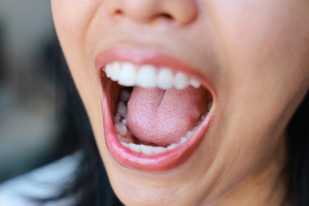 Fillings Brownsville